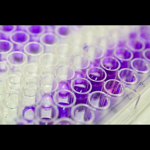 [0015-980-100-PHG] Human Antisize:H. Influenzae B polyribosyl phosphate  Hibsize:PRP  IgG ELISA Kit, 96 tests, Quantitative